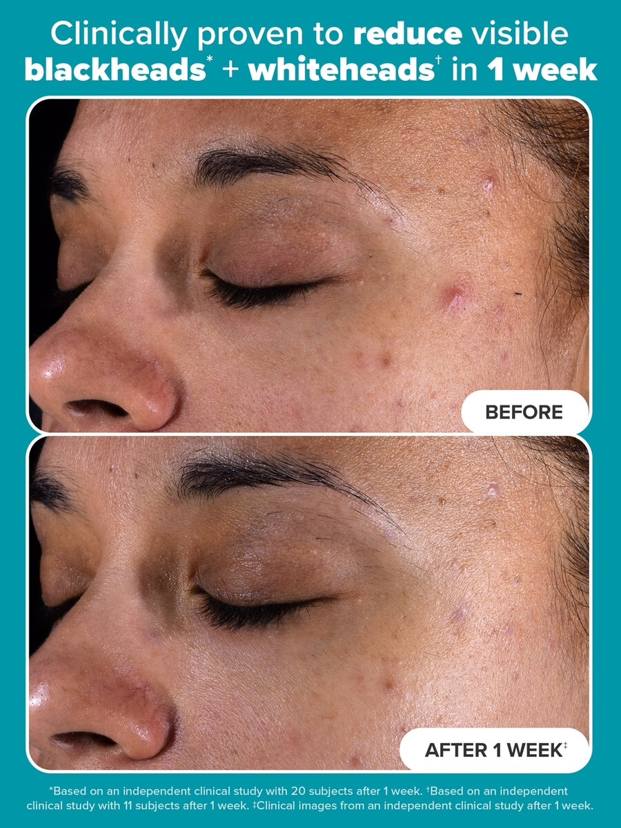skin perfectioning 2 bha flydende eksfolierende