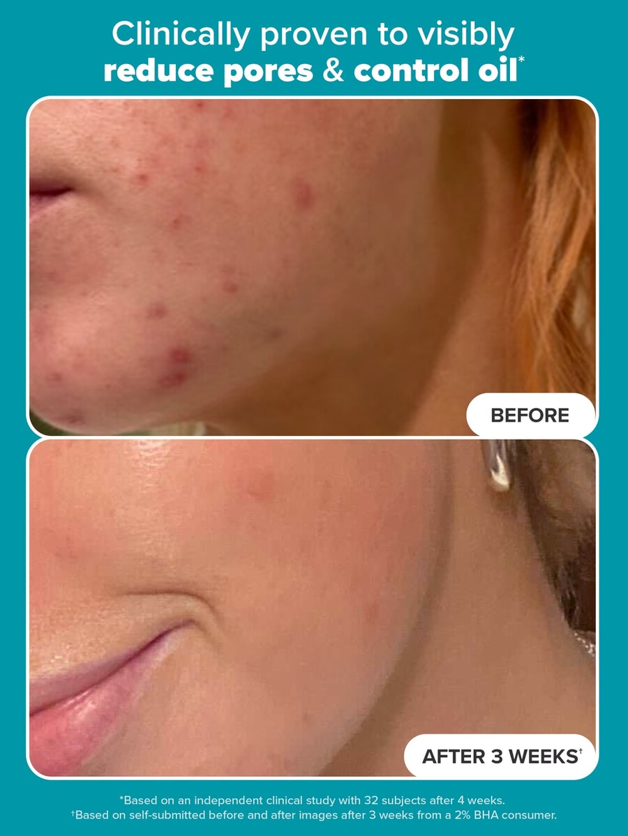 skin perfectioning 2 bha flydende eksfolierende