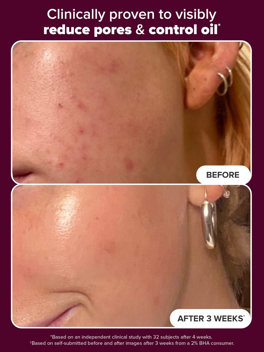holiday edition 2 bha eksfolierende toner