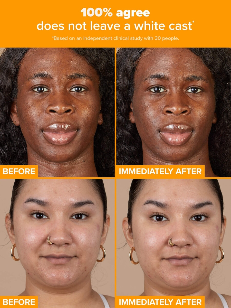 5 c-vitamin transparent fugtighedscreme spf 50