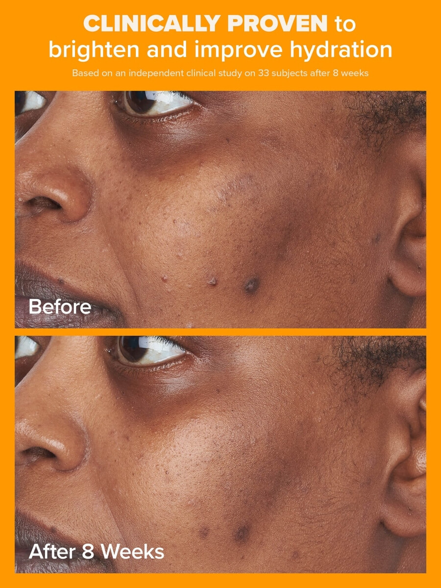5 c-vitamin transparent fugtighedscreme spf 50