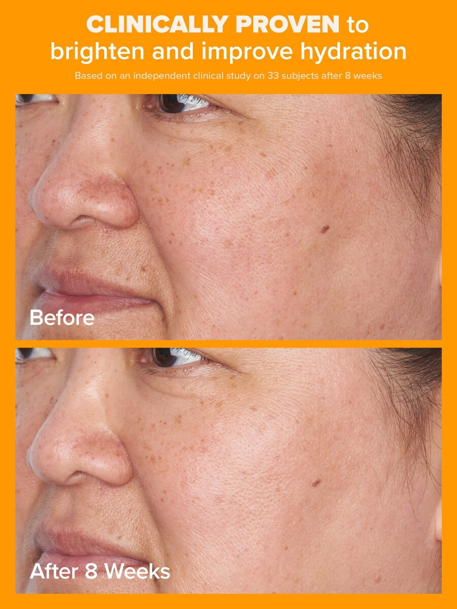 5 c-vitamin transparent fugtighedscreme spf 50